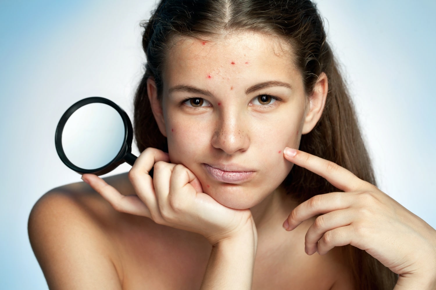 Az 5 leggyakoribb bőrbetegség – téged melyik kínoz?