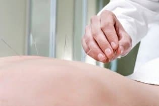 Az akupunktúra és fogyás