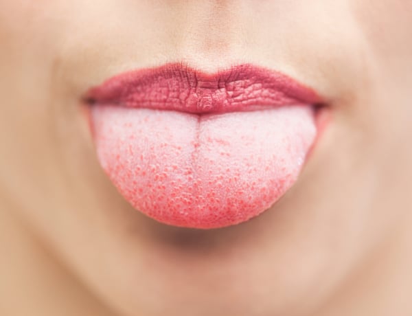 10 ok, amiért duzzadt a nyelved – Nem kell megijedni!
