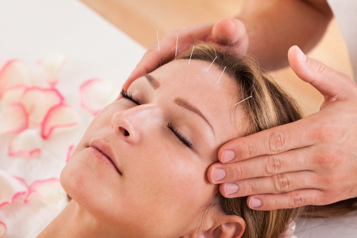 Acupuncture for Better Sleep