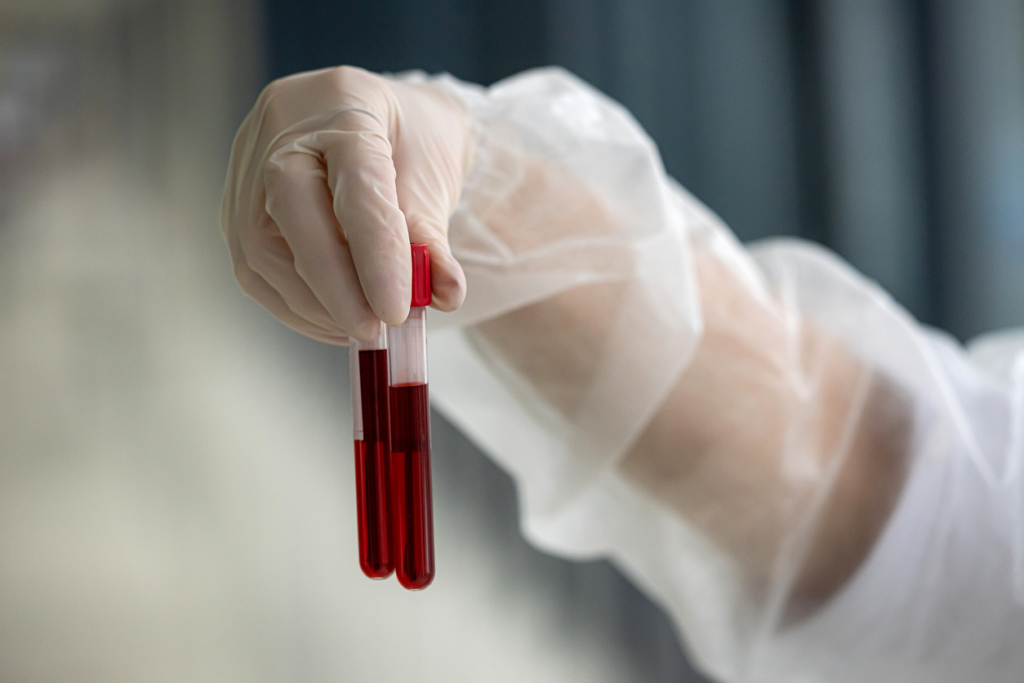 A hosszabb élet titka