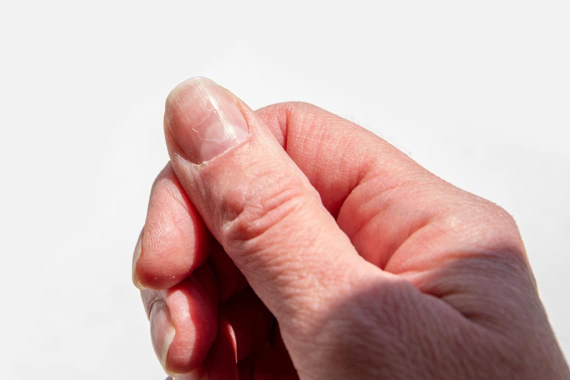 Kanál formájú körmök