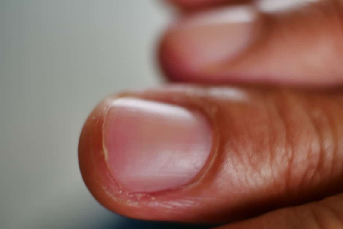 Óra üvegéhez hasonló, domború körmök