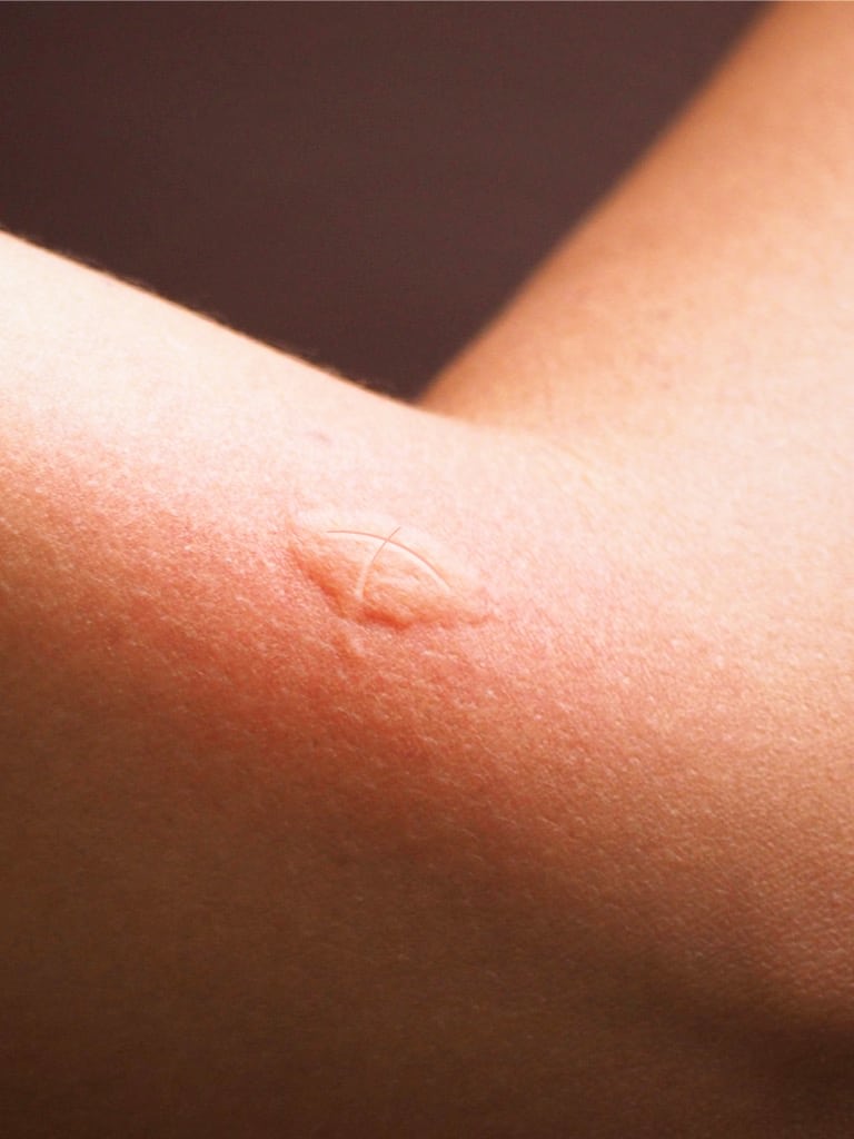 Egy nagy „X” a közepébe – IGEN