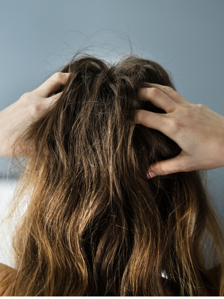 Túl erősen dörzsölöd a fejbőrödet