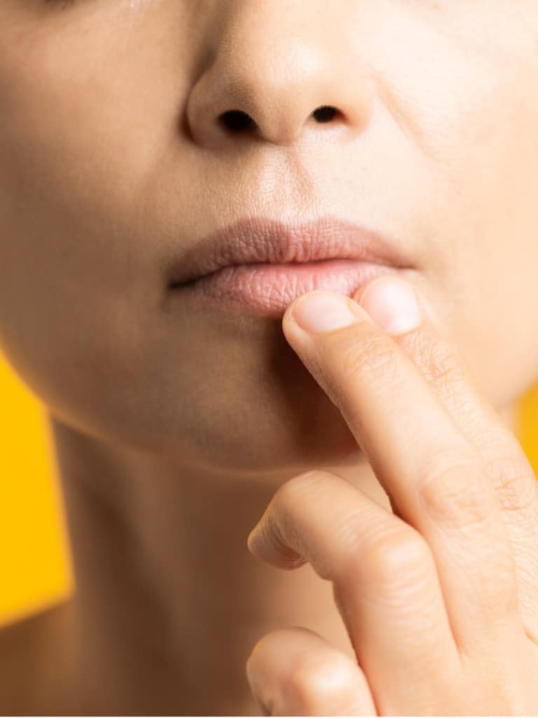 Ráncok a felső ajkaidon