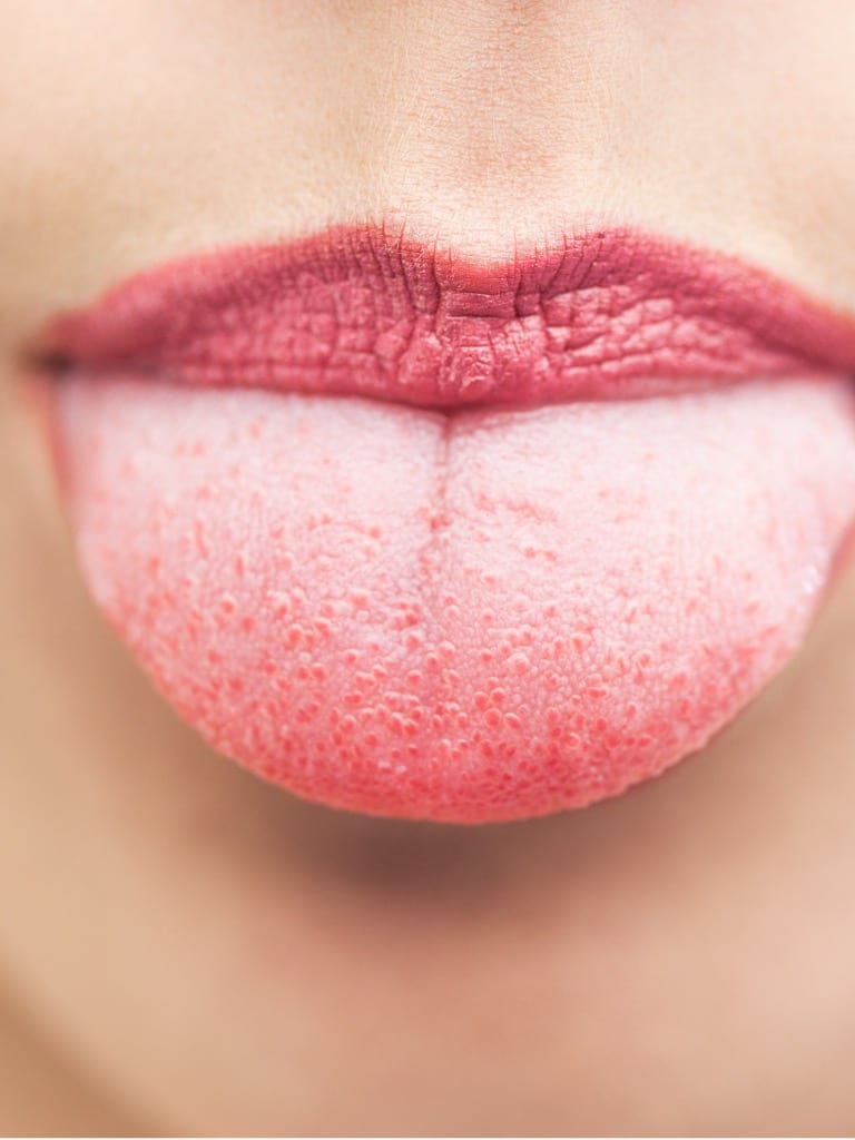 Ha elváltozást tapasztalsz a nyelveden