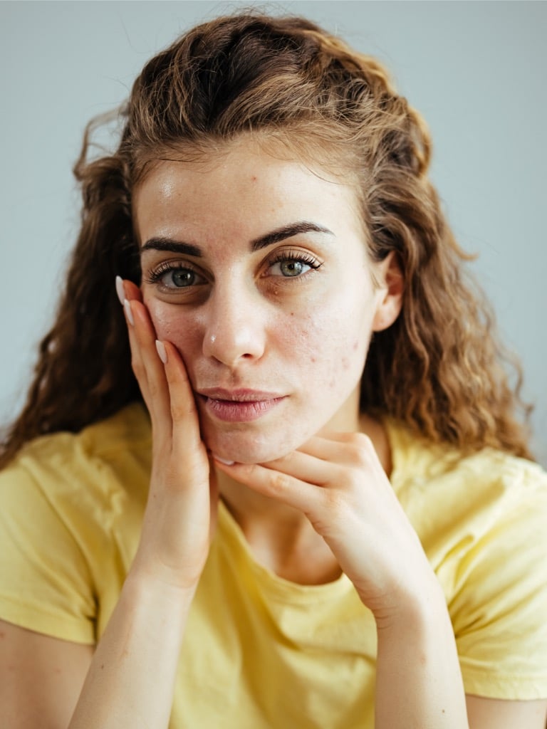 Mit takar a bőrböjt?