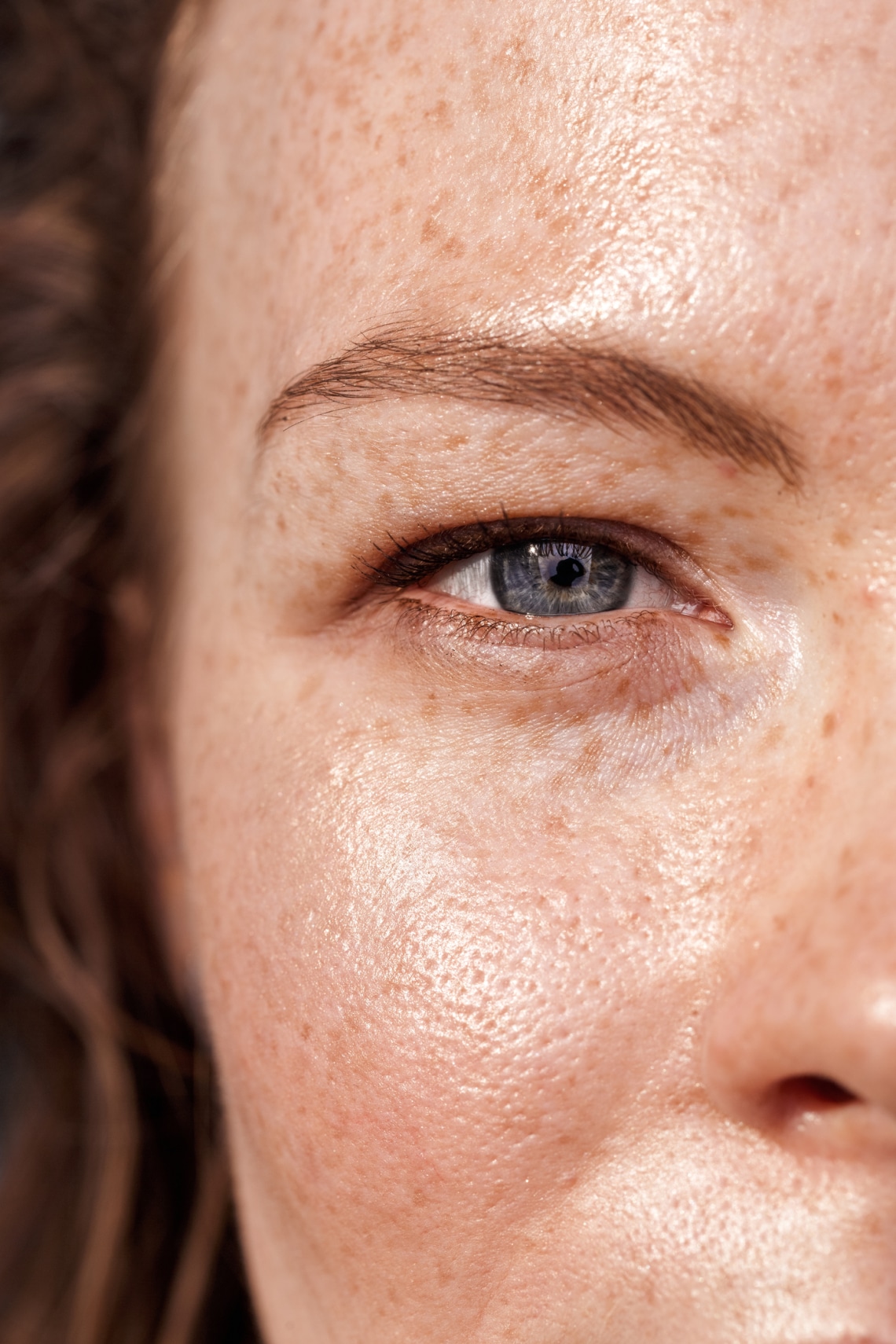 Botox-baki és túl nagy különbségek