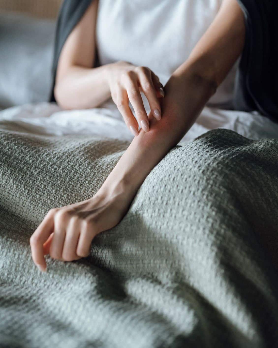 Allergiás reakciók