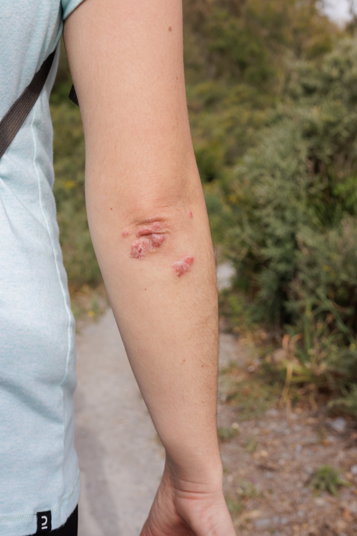 Csökkenti a gyulladást