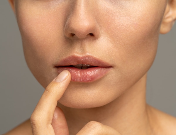 Mit egyél, hogy gyorsabban gyógyuljon a herpeszed?