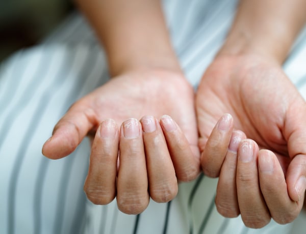 10 tünet és betegség, mely a körmök egészségtelen állapotára hívja fel a figyelmet