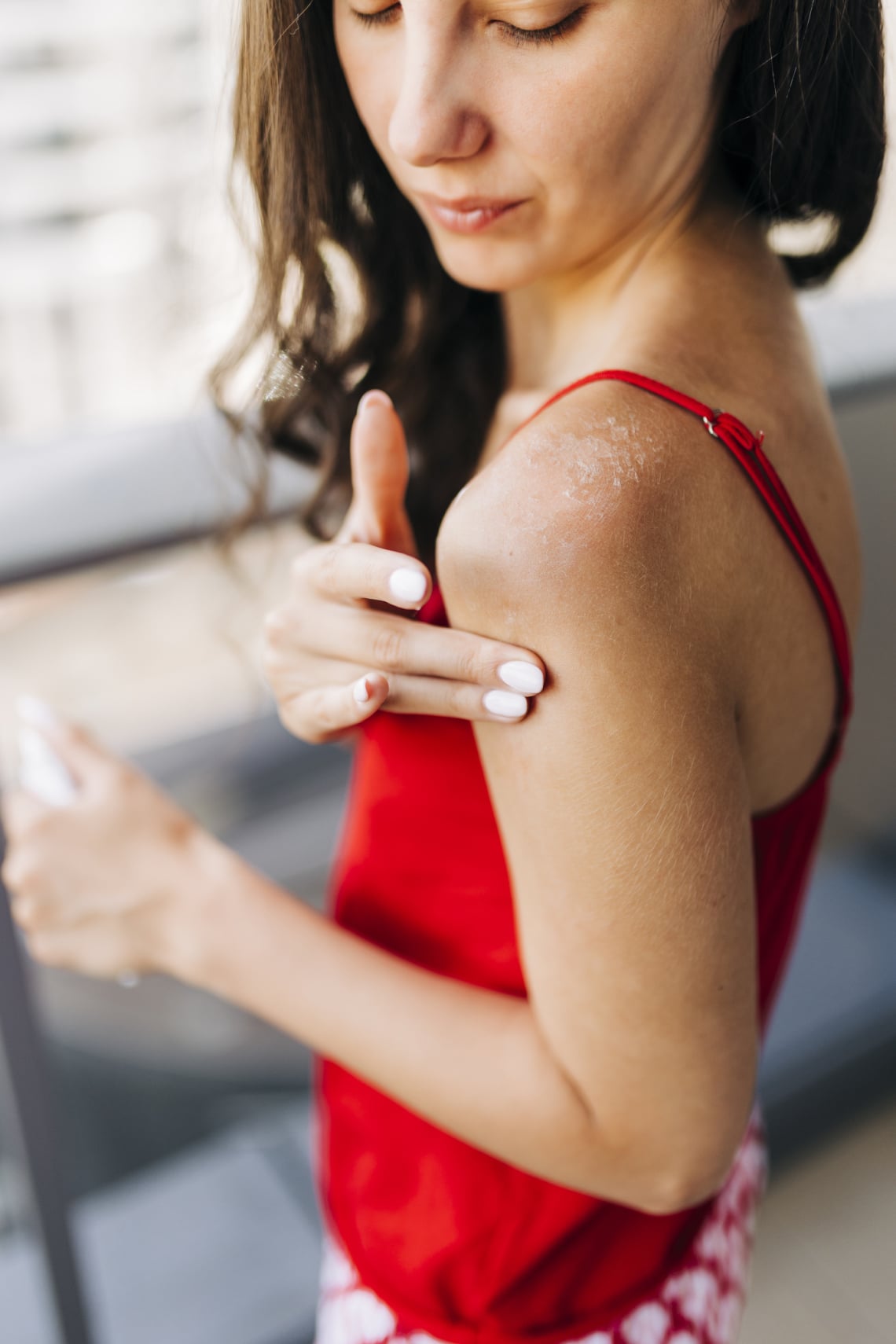 Napégés után is csodálatos