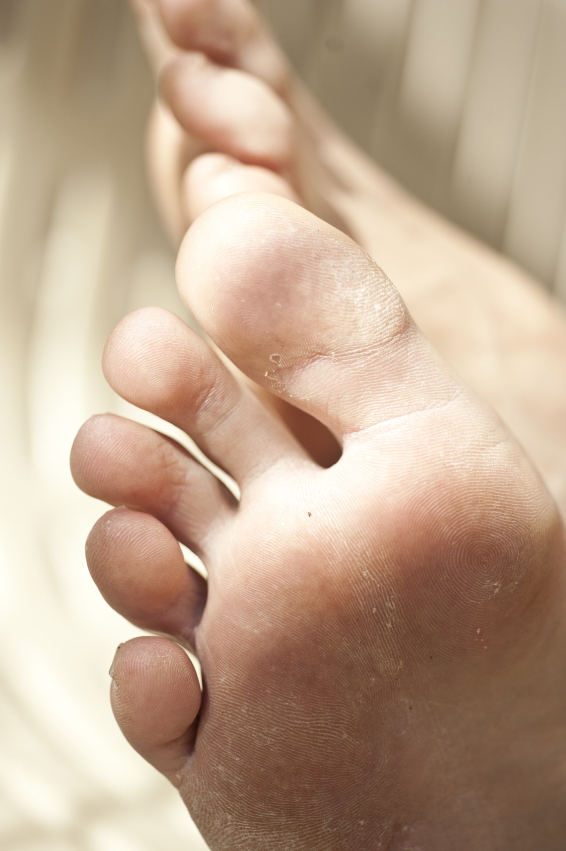 Lehet, hogy „csak” lábgombád van