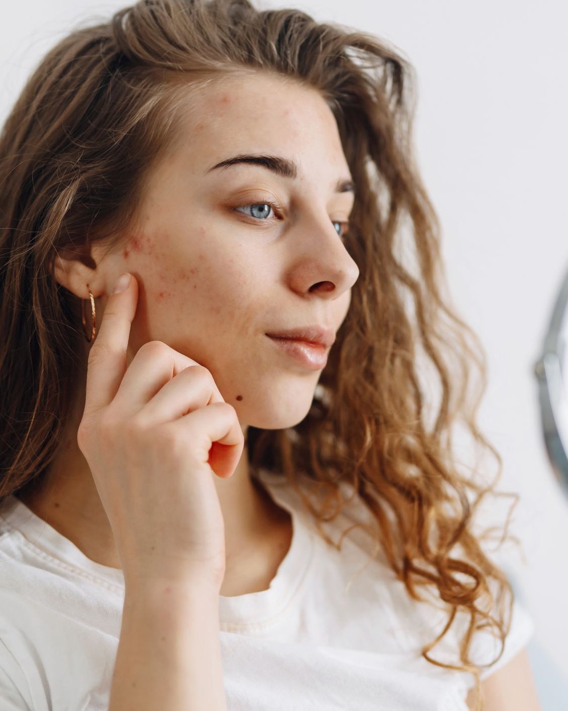 Honnan tudhatom, hogy a bőröm tisztulási folyamaton megy keresztül, vagy pattanásosodik?