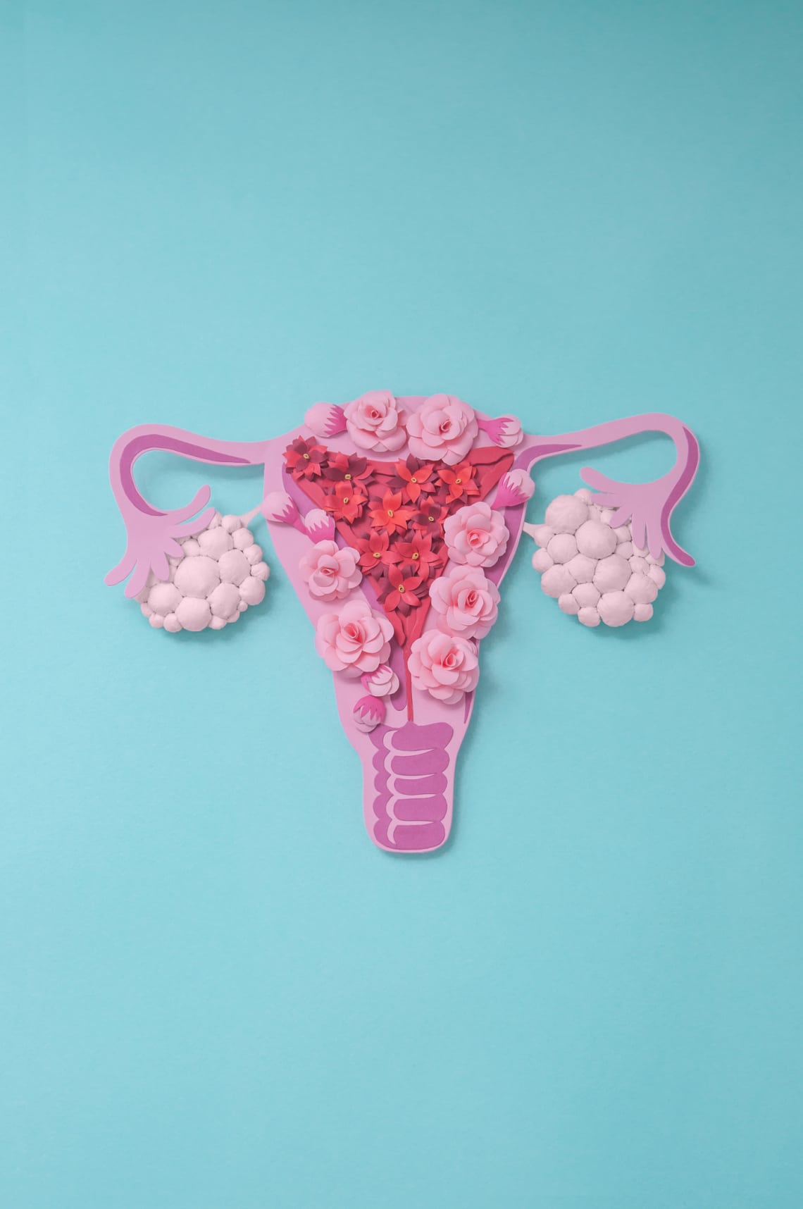 PCOS