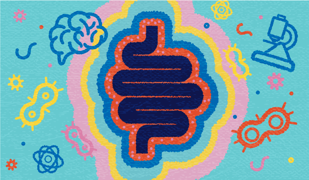 D-vitamin hiánya és vastagbélrák