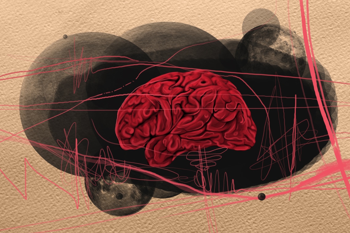 3 dolog, ami növeli a rokkantságot okozó stroke esélyét