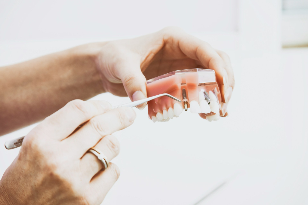 Mit érdemes tudni a fogászati implantációról?