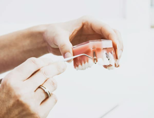 Mit érdemes tudni a fogászati implantációról?