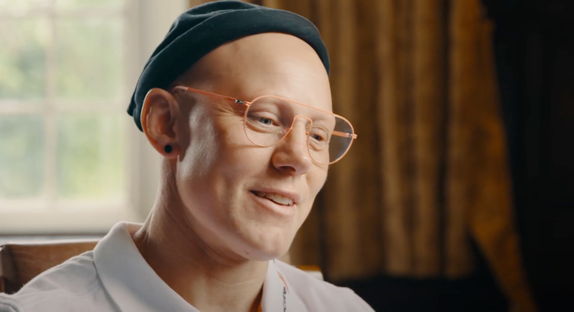 A nő, akinek az összes haja kihullott 5 hét alatt, mégis világhírű sportoló és motivátor