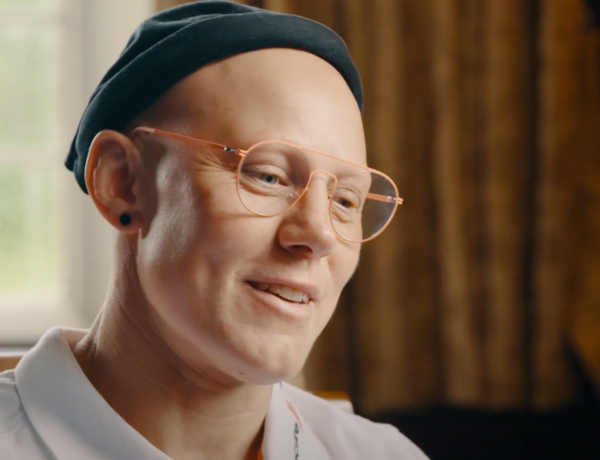 A nő, akinek az összes haja kihullott 5 hét alatt, mégis világhírű sportoló és motivátor