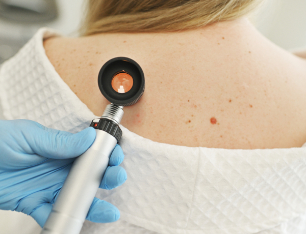 Új kutatás: egy gyakori vírus is szerepet játszhat a bőrrák kialakulásában