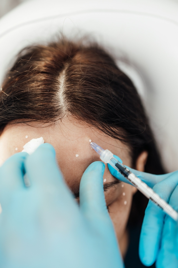 Homlok botox