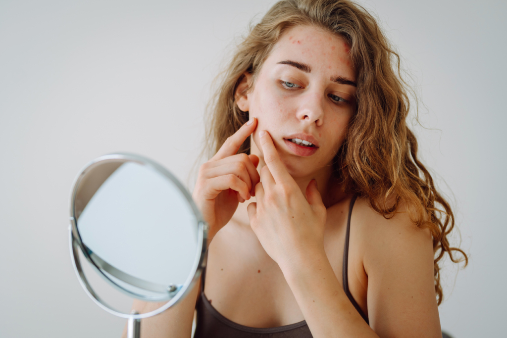Pattanások, szárazság, ragyogás: így változik a bőröd a menstruációs ciklusod során