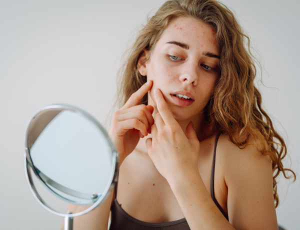 Pattanások, szárazság, ragyogás: így változik a bőröd a menstruációs ciklusod során