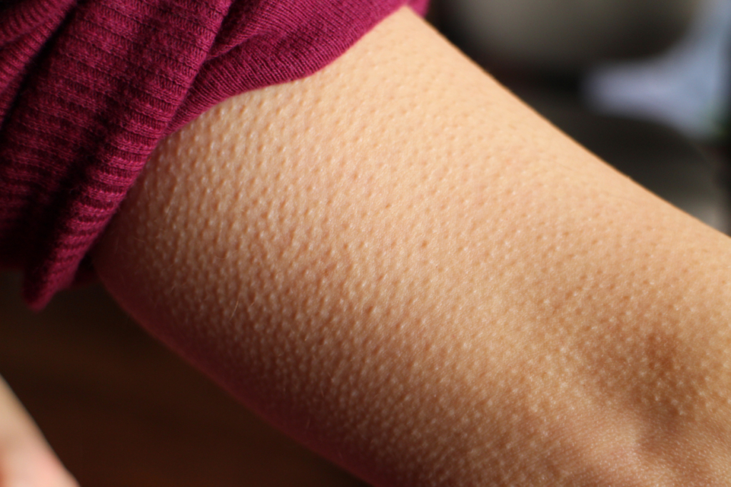 Miért csuklunk, és miért leszünk libabőrösek? Ősi reflexek állnak a háttérben