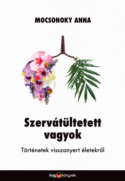 Mocsonoky Anna: Szervátültetett vagyok