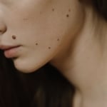 Mit árulnak el az anyajegyeid az előző életedből származó sebeidről?