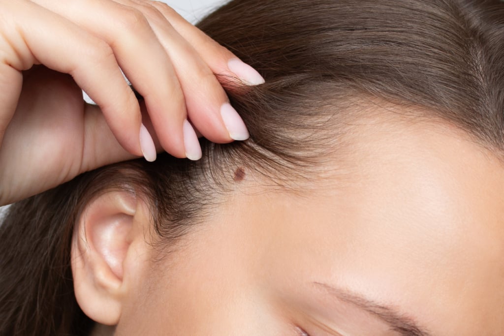 Ha ezen a 3 helyen van anyajegyed, ősi gyógyító erő rejtőzik benned